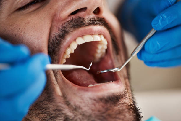 Best Urgent Tooth Repair  in Bedford, TX